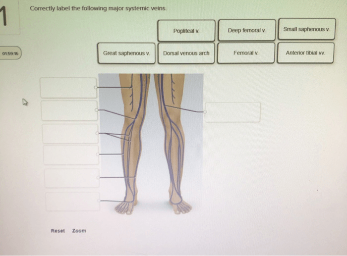 Correctly label the following major systemic veins