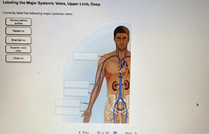 Veins label following major systemic solved chegg transcribed problem text been show has